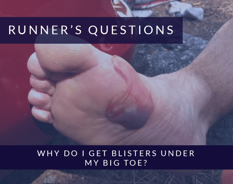 Why do I get blisters under my big toe after running?